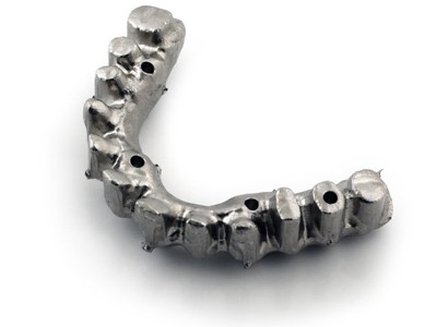 CRCO screw retained bridges