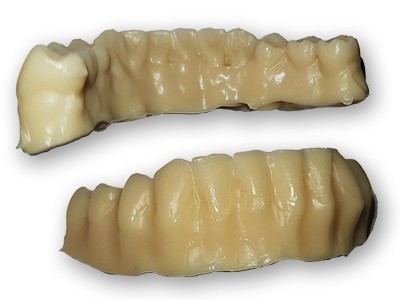 Full denture